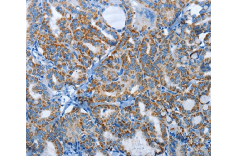 Immunohistochemistry - AGL Antibody from Signalway Antibody (37366) - Antibodies.com