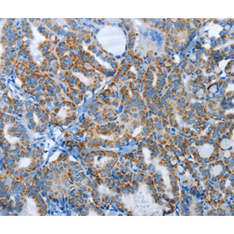 Immunohistochemistry - AGL Antibody from Signalway Antibody (37366) - Antibodies.com