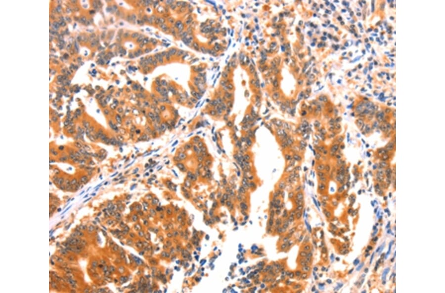 Immunohistochemistry - AK5 Antibody from Signalway Antibody (37394) - Antibodies.com
