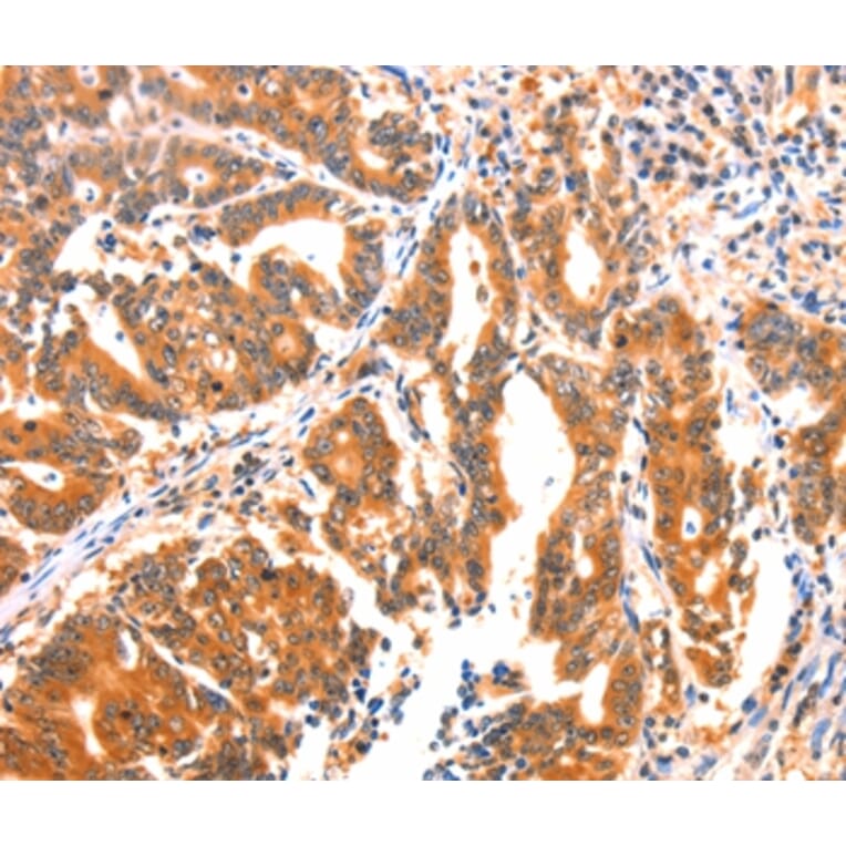 Immunohistochemistry - AK5 Antibody from Signalway Antibody (37394) - Antibodies.com