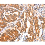 Immunohistochemistry - AK5 Antibody from Signalway Antibody (37394) - Antibodies.com