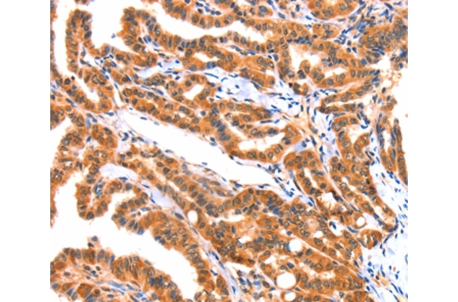 Immunohistochemistry - AK5 Antibody from Signalway Antibody (37394) - Antibodies.com