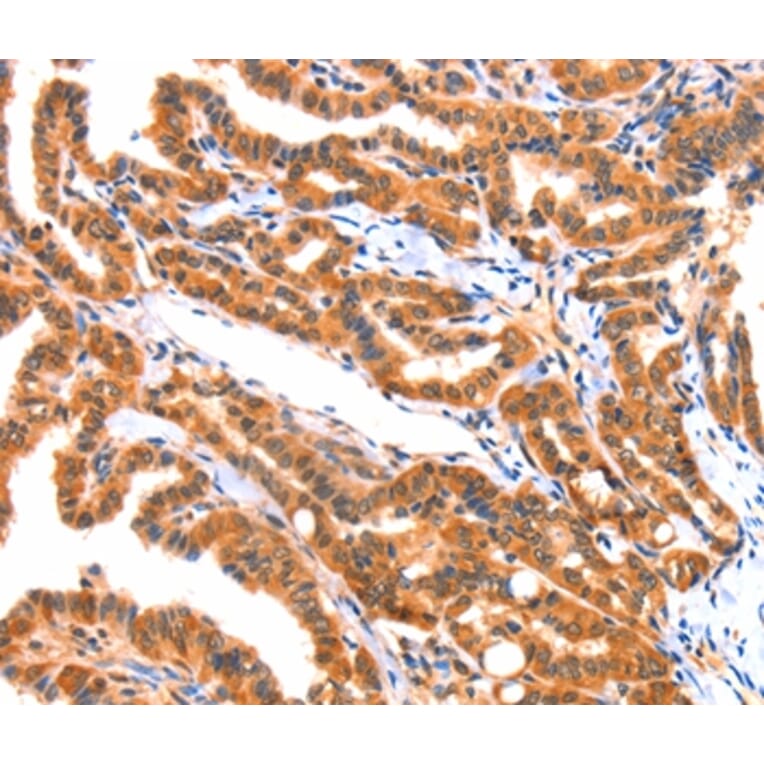 Immunohistochemistry - AK5 Antibody from Signalway Antibody (37394) - Antibodies.com