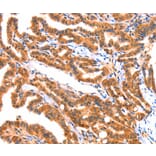 Immunohistochemistry - AK5 Antibody from Signalway Antibody (37394) - Antibodies.com