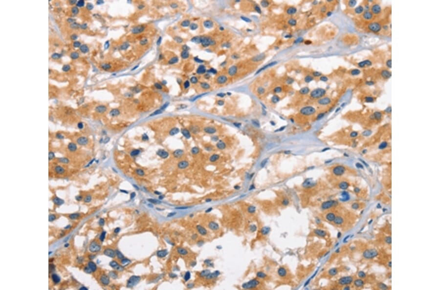 Immunohistochemistry - AHR Antibody from Signalway Antibody (37415) - Antibodies.com