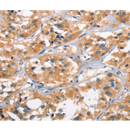 Immunohistochemistry - AHR Antibody from Signalway Antibody (37415) - Antibodies.com