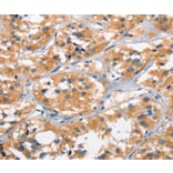 Immunohistochemistry - AHR Antibody from Signalway Antibody (37415) - Antibodies.com