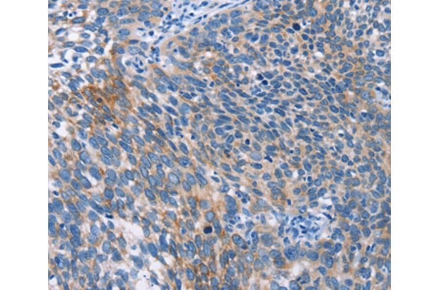 Immunohistochemistry - AHR Antibody from Signalway Antibody (37415) - Antibodies.com