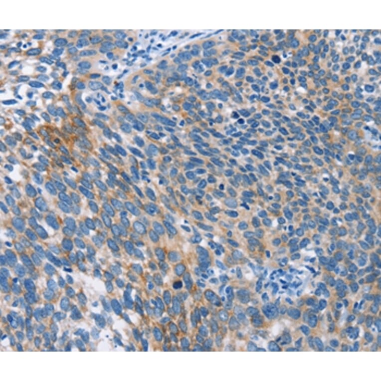 Immunohistochemistry - AHR Antibody from Signalway Antibody (37415) - Antibodies.com