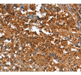 Immunohistochemistry - CR1 Antibody from Signalway Antibody (37501) - Antibodies.com