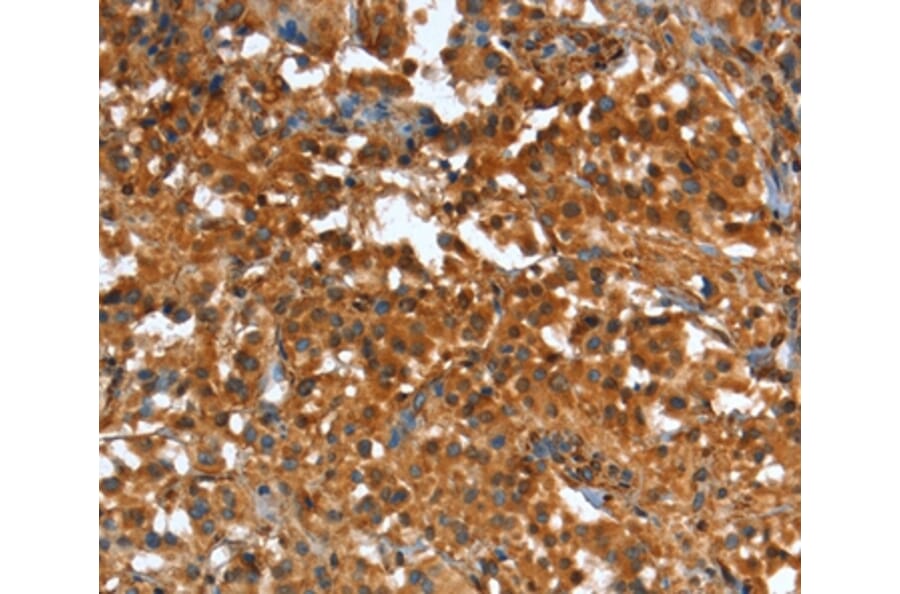 Immunohistochemistry - CR1 Antibody from Signalway Antibody (37501) - Antibodies.com
