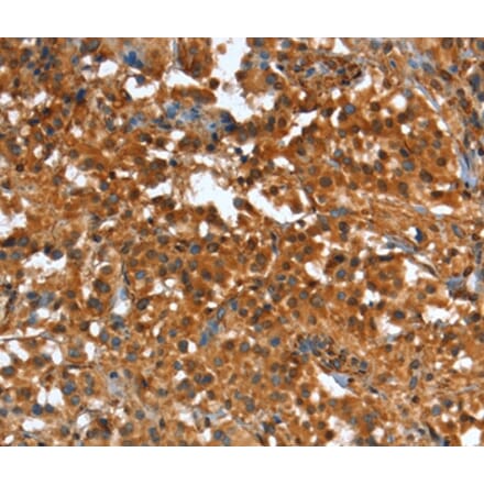 Immunohistochemistry - CR1 Antibody from Signalway Antibody (37501) - Antibodies.com