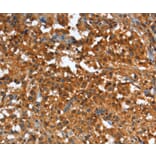Immunohistochemistry - CR1 Antibody from Signalway Antibody (37501) - Antibodies.com