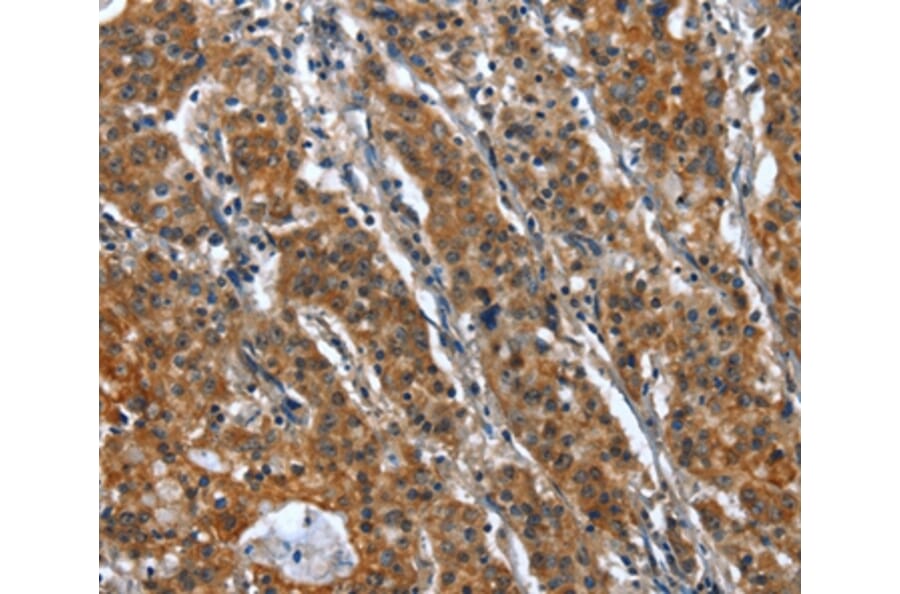 Immunohistochemistry - CR1 Antibody from Signalway Antibody (37501) - Antibodies.com