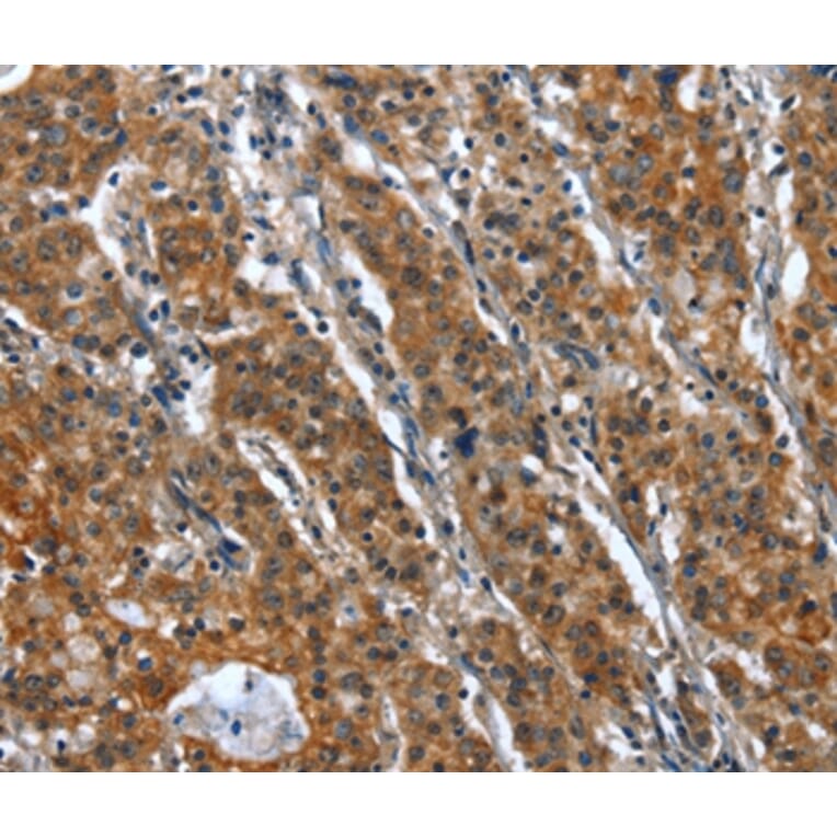 Immunohistochemistry - CR1 Antibody from Signalway Antibody (37501) - Antibodies.com
