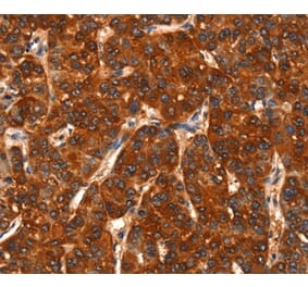 Immunohistochemistry - DHH Antibody from Signalway Antibody (37533) - Antibodies.com