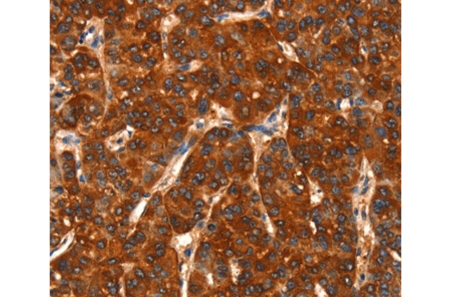 Immunohistochemistry - DHH Antibody from Signalway Antibody (37533) - Antibodies.com