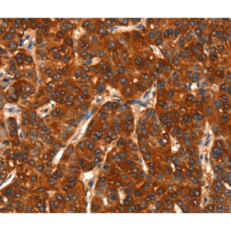 Immunohistochemistry - DHH Antibody from Signalway Antibody (37533) - Antibodies.com