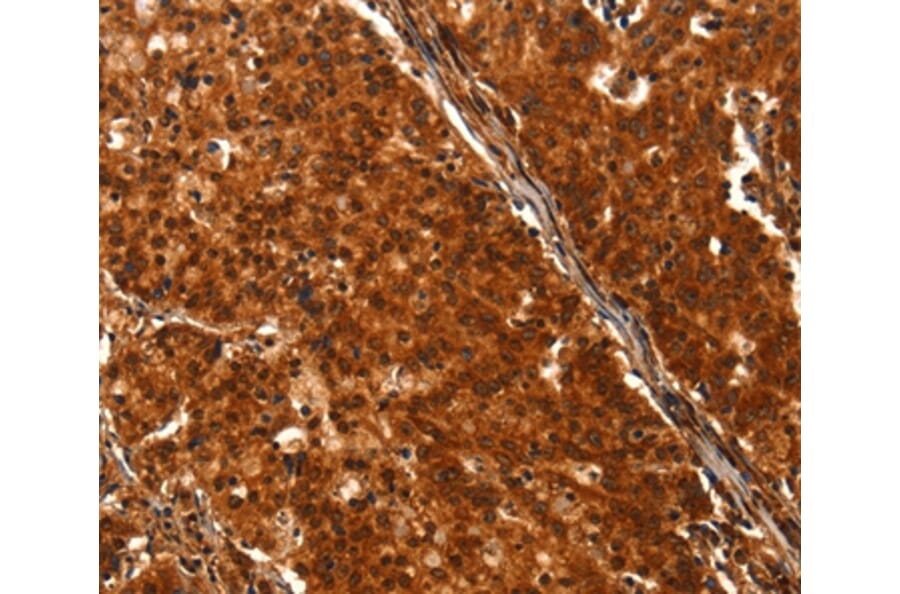 Immunohistochemistry - DHH Antibody from Signalway Antibody (37533) - Antibodies.com