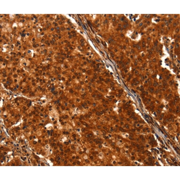 Immunohistochemistry - DHH Antibody from Signalway Antibody (37533) - Antibodies.com