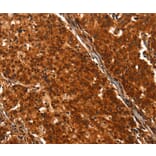 Immunohistochemistry - DHH Antibody from Signalway Antibody (37533) - Antibodies.com