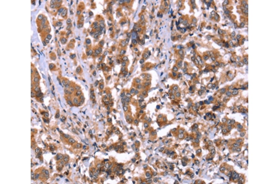 Immunohistochemistry - HRG Antibody from Signalway Antibody (37628) - Antibodies.com