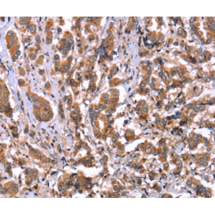 Immunohistochemistry - HRG Antibody from Signalway Antibody (37628) - Antibodies.com