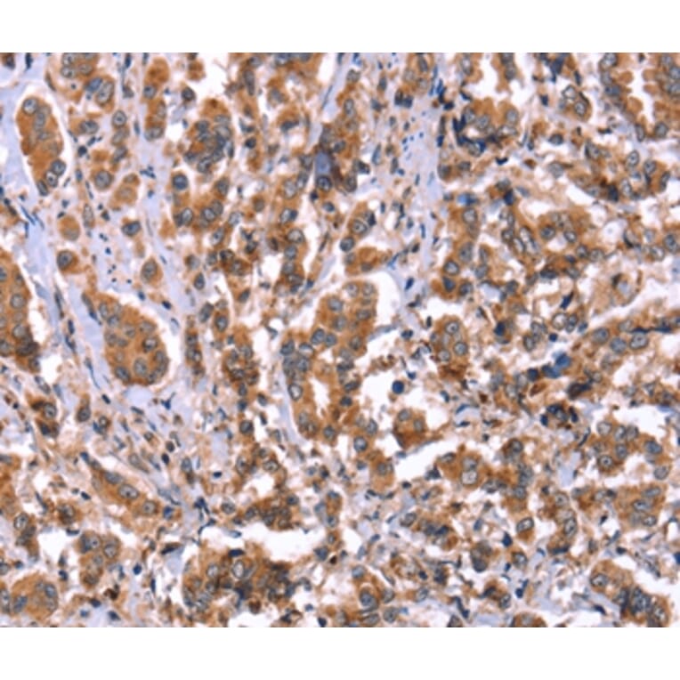 Immunohistochemistry - HRG Antibody from Signalway Antibody (37628) - Antibodies.com