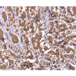 Immunohistochemistry - HRG Antibody from Signalway Antibody (37628) - Antibodies.com