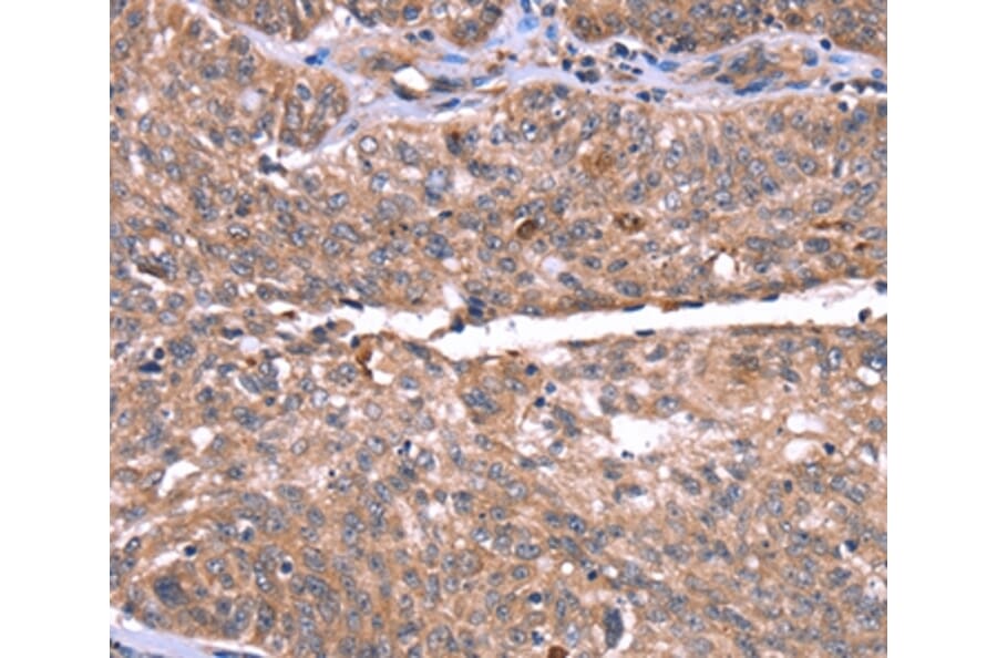 Immunohistochemistry - HRG Antibody from Signalway Antibody (37628) - Antibodies.com