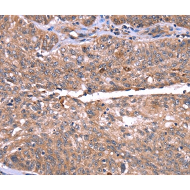 Immunohistochemistry - HRG Antibody from Signalway Antibody (37628) - Antibodies.com
