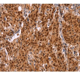 Immunohistochemistry - HRK Antibody from Signalway Antibody (37633) - Antibodies.com