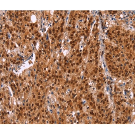 Immunohistochemistry - HRK Antibody from Signalway Antibody (37633) - Antibodies.com