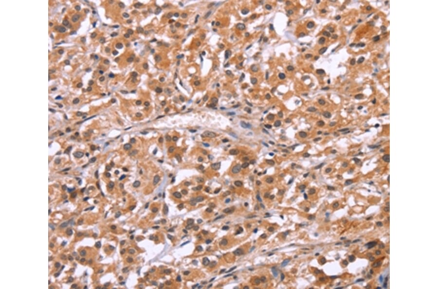 Immunohistochemistry - HRK Antibody from Signalway Antibody (37633) - Antibodies.com