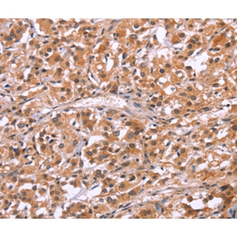 Immunohistochemistry - HRK Antibody from Signalway Antibody (37633) - Antibodies.com