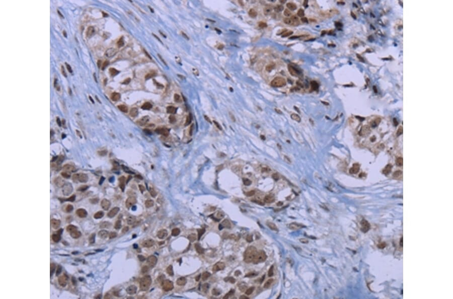 Immunohistochemistry - ID3 Antibody from Signalway Antibody (37640) - Antibodies.com
