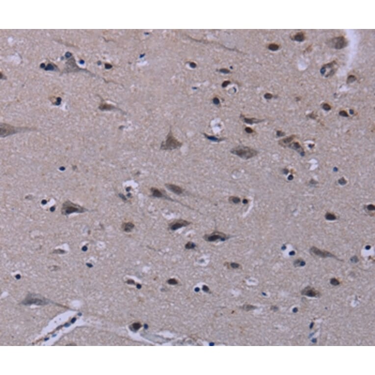 Immunohistochemistry - ID3 Antibody from Signalway Antibody (37640) - Antibodies.com