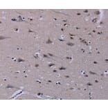 Immunohistochemistry - ID3 Antibody from Signalway Antibody (37640) - Antibodies.com