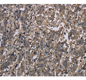 Immunohistochemistry - MCC Antibody from Signalway Antibody (37718) - Antibodies.com
