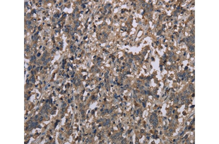 Immunohistochemistry - MCC Antibody from Signalway Antibody (37718) - Antibodies.com