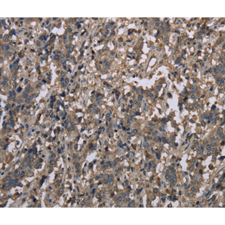 Immunohistochemistry - MCC Antibody from Signalway Antibody (37718) - Antibodies.com