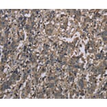 Immunohistochemistry - MCC Antibody from Signalway Antibody (37718) - Antibodies.com