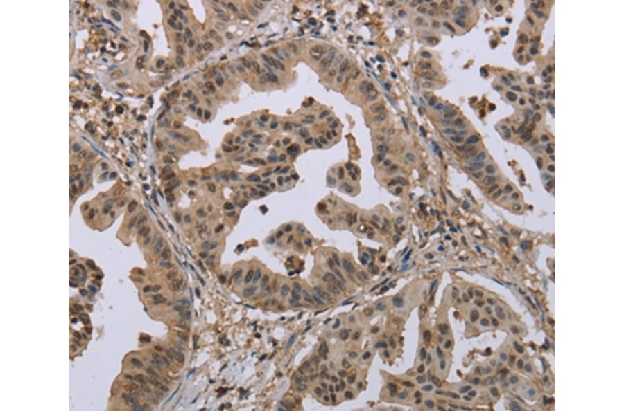 Immunohistochemistry - MCC Antibody from Signalway Antibody (37718) - Antibodies.com