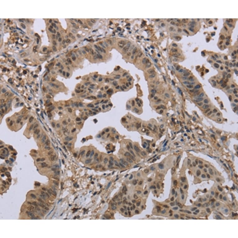 Immunohistochemistry - MCC Antibody from Signalway Antibody (37718) - Antibodies.com