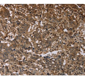 Immunohistochemistry - MFF Antibody from Signalway Antibody (37723) - Antibodies.com