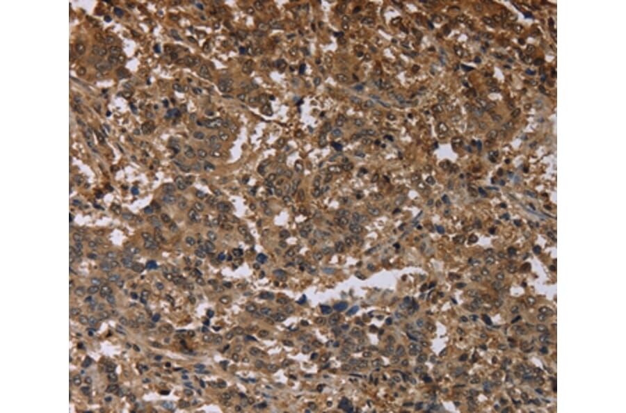 Immunohistochemistry - MFF Antibody from Signalway Antibody (37723) - Antibodies.com