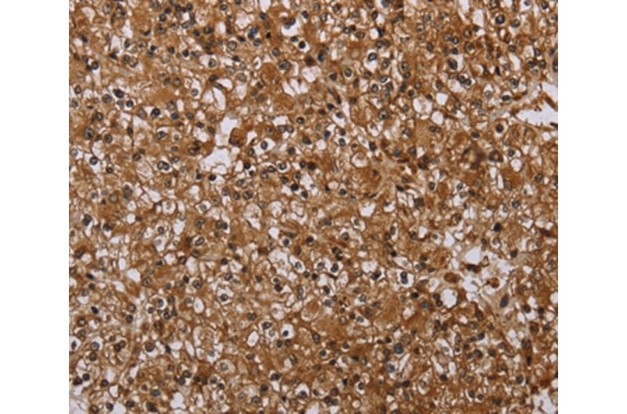 Immunohistochemistry - MFF Antibody from Signalway Antibody (37723) - Antibodies.com