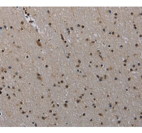 Immunohistochemistry - MVD Antibody from Signalway Antibody (37745) - Antibodies.com