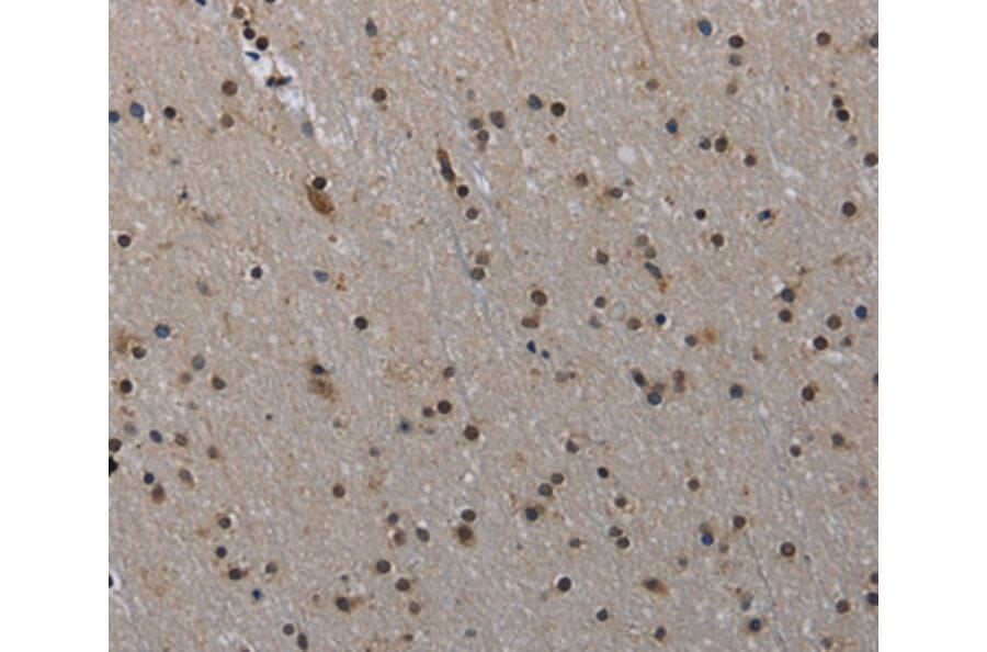 Immunohistochemistry - MVD Antibody from Signalway Antibody (37745) - Antibodies.com