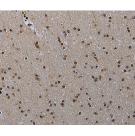 Immunohistochemistry - MVD Antibody from Signalway Antibody (37745) - Antibodies.com
